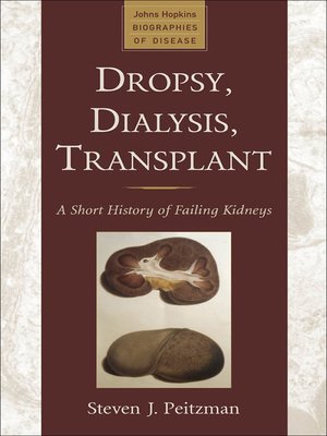 cover image of Dropsy, Dialysis, Transplant